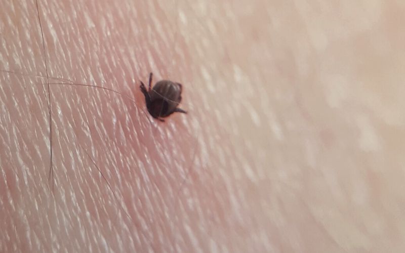 A tick lodged into skin