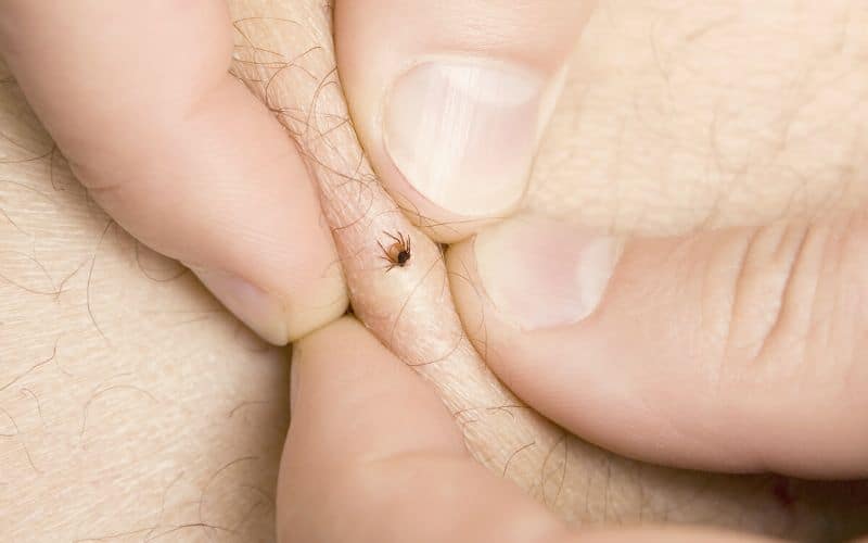 Removing a tick from a human using fingers 